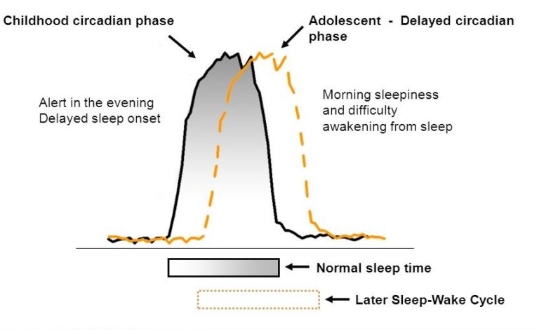 How Much Sleep Is Your Teenager Getting? - Millpond